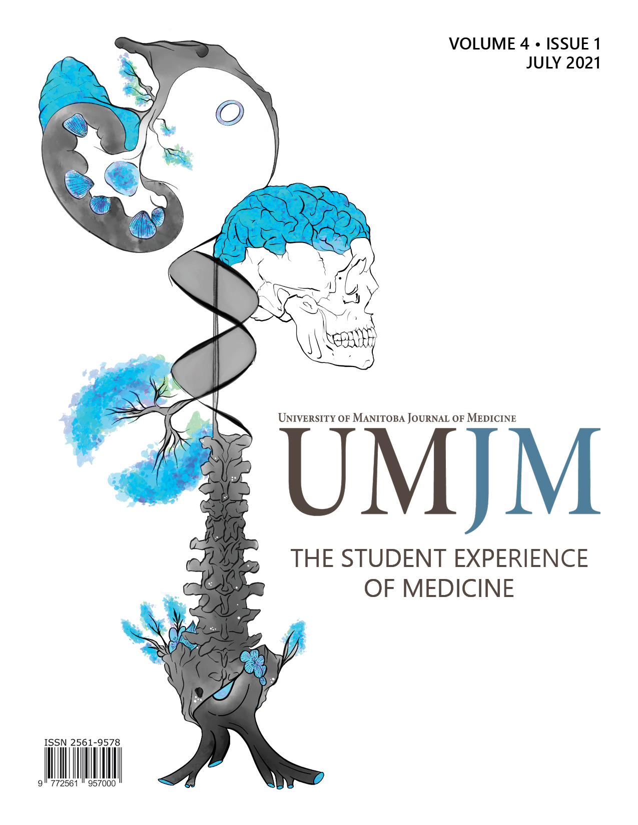 A case of stroke mimic in the setting of metastatic melanoma